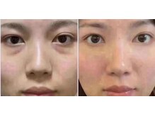 ビビッド(ViViD)/