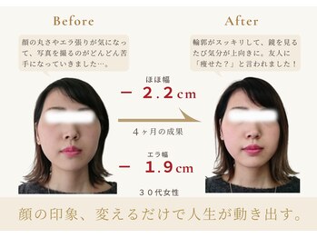 アロハ(ALOHA.)/印象美、変えるだけで人生が変化