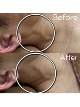 カシェボーテ(CACHE BEAUTE)/