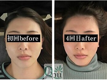 キュープ 鹿児島伊集院店(Qpu)/