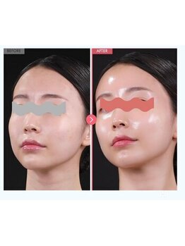 ラグラン銀座メディカルエステ 高輪ゲートウェイ店/乾燥・くすみ・ごわつき改善