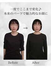 シナジェ 並木通り店(Synergye)/歪み改善＝さらに美しく★