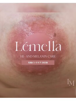 エルビービュティーサロン(LB BEAUTY SALON)/【ルメラ乳輪】実績数関西1★