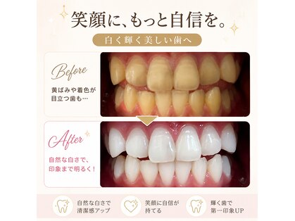 ホワイトニングショップ 宇城店の写真