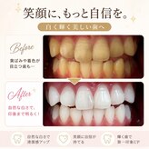 ホワイトニングショップ 宇城店