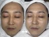 【ニキビ・毛穴のメンテナンスケア】肌診断+オーダーメイド毛穴ケア