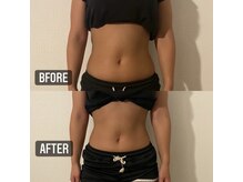 寝るジム for yuu(寝るジム フォーユー)/【ビフォアフター】