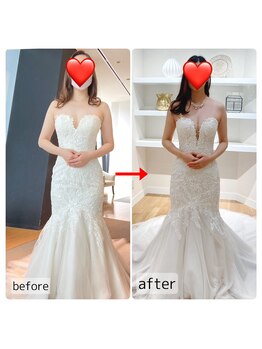 フラフィ 宇都宮本店(fluffy)/ブライダルのお客様☆バストケア