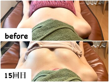 つばききよら/バストがコンプレックスで…