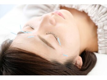 マル整体院(MARU)/美容鍼でお顔スッキリ美肌へ