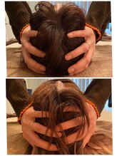 リモド(Rimodo509)/小顔矯正（ヘッドスパ