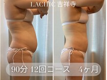 ラシク 吉祥寺(LACHIC)
