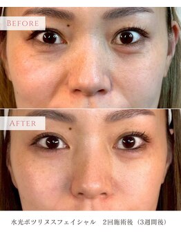 リセットヘアアンドアイラッシュ(Re:set)/ボニックス（2回目）