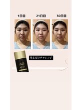 エトワール(etoile)/大人気！！