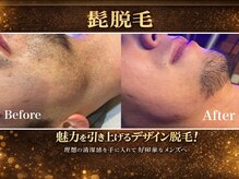 ハモンド(Hammond)