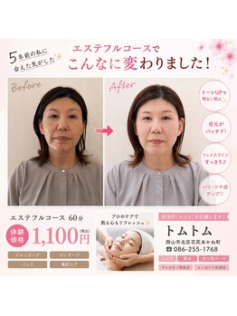 トム トム/体験エステ　1,100円