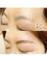 クレー(Klee)/アイブロウリフト