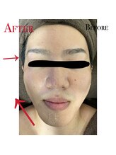 アリッチ 岡崎店(a.Rich)/フェイスラインイケメン！