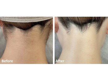 アールイー(Re:)/