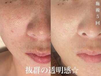 ダン(dan)/【陶肌トリートメント】症例