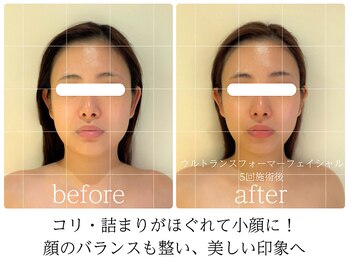 ライフチャージ(Life Charge)/原因を改善→理想の小顔＆身体へ