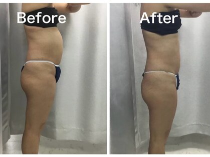 マッチ(much)の写真