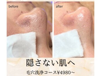 ラ ドウ 名古屋黒川店(la.dow)/ごっそりパック&毛穴洗浄¥6980