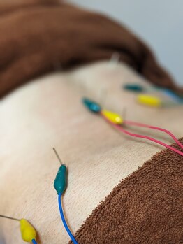 乃々鍼灸整体院 表参道/鍼灸×整体