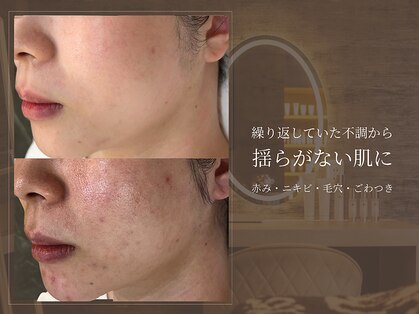 サロン ド ボーテ シャルル(Chaleureux)の写真
