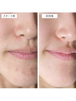 スパチャーレ(Spa ciare)/肌ファス