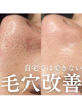 エトレ(ETOLE)/毛穴の中から徹底洗浄★☆