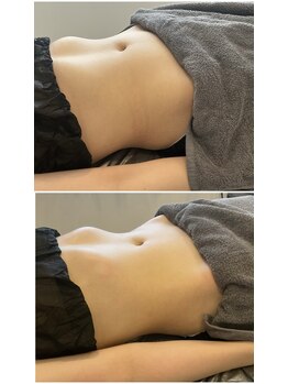 ウル(Ulu)/腸もみビフォーアフター