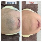 ベレッツァ 正雀店(Bellezza)