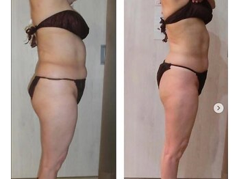 アンジェリーク/溶ける脂肪燃焼サイズダウン60分