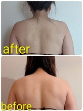 ヨサパーク アカーシャ(YOSA PARK AKASHA)/肩こりでお悩みの方に