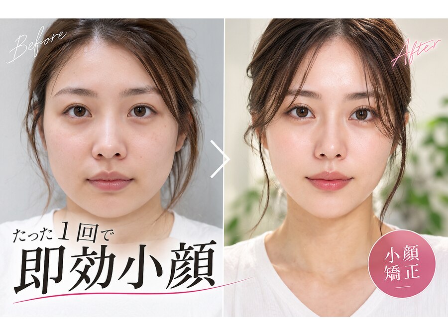 小顔矯正プロの予約ページ掲載写真