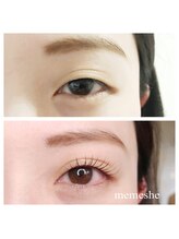 メメシー 相模原(memeshe)/ビフォー/ アフター