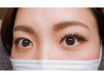 キャッツアイ(cat's eye)/左右こんなにも違います★