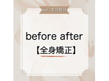 イカル 池袋(ikaru)/ikaru美容整体 before after 