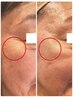 【初回】プロのお手入れで変化する乾燥や小じわ、毛穴、しみケアが気になる方