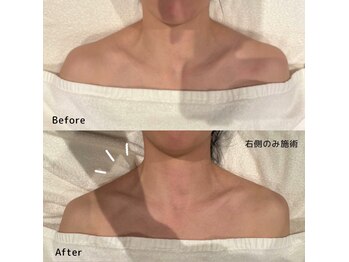 パウ(Paw)/変化写真