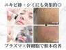 【エイジングケア】100％ヒト幹細胞導入＋復元パック<<集中ケア>>￥20,800