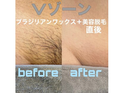 キカ(kika)の写真