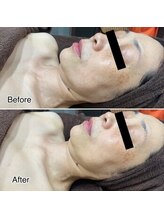 ラブームココ(LaBoom CoCo)/小顔ケアはコレ★