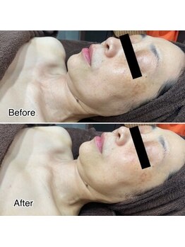 ラブームココ(LaBoom CoCo)/小顔ケアはコレ★