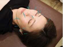 桜通りはりきゅう整骨院