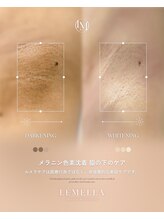 エルビービュティーサロン(LB BEAUTY SALON)/【ルメラ乳輪】実績数関西1★