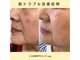 ピーナップ(P-nap)の写真