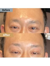 眉毛ハウス 吉祥寺店(眉毛HOUSE)/お客様の施術例(吉祥寺/東京)