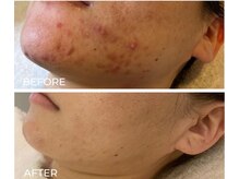 トット 恵比寿(totto)/ケア症例